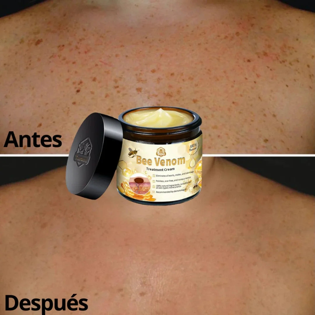 🐝CREMA DE VENENO DE ABEJAS⚕️