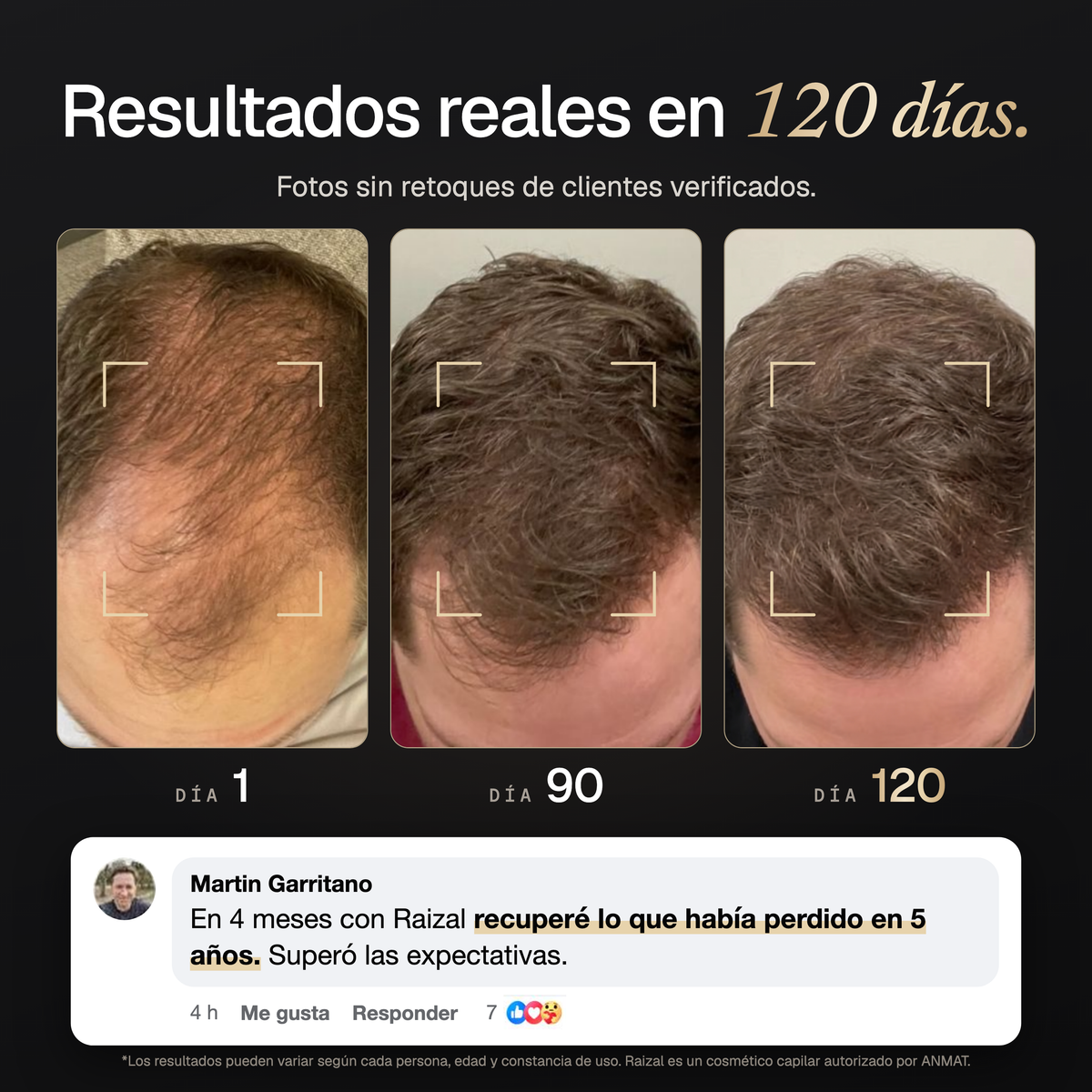 RAIZAL™ - Shampoo Activador de Raices Capilares