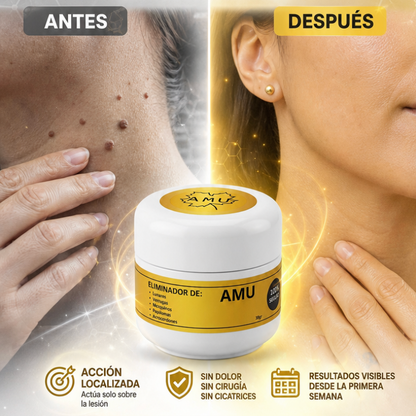 Crema Amu eliminador de verrugas, lunares, mexquinos, piojos y acrocordones