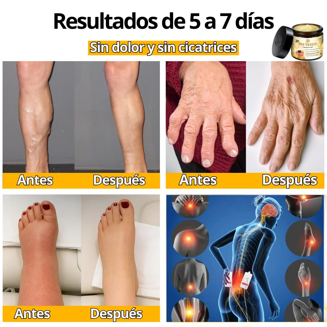 CREMA VENENO DE ABEJAS PARA ARTICULACIONES