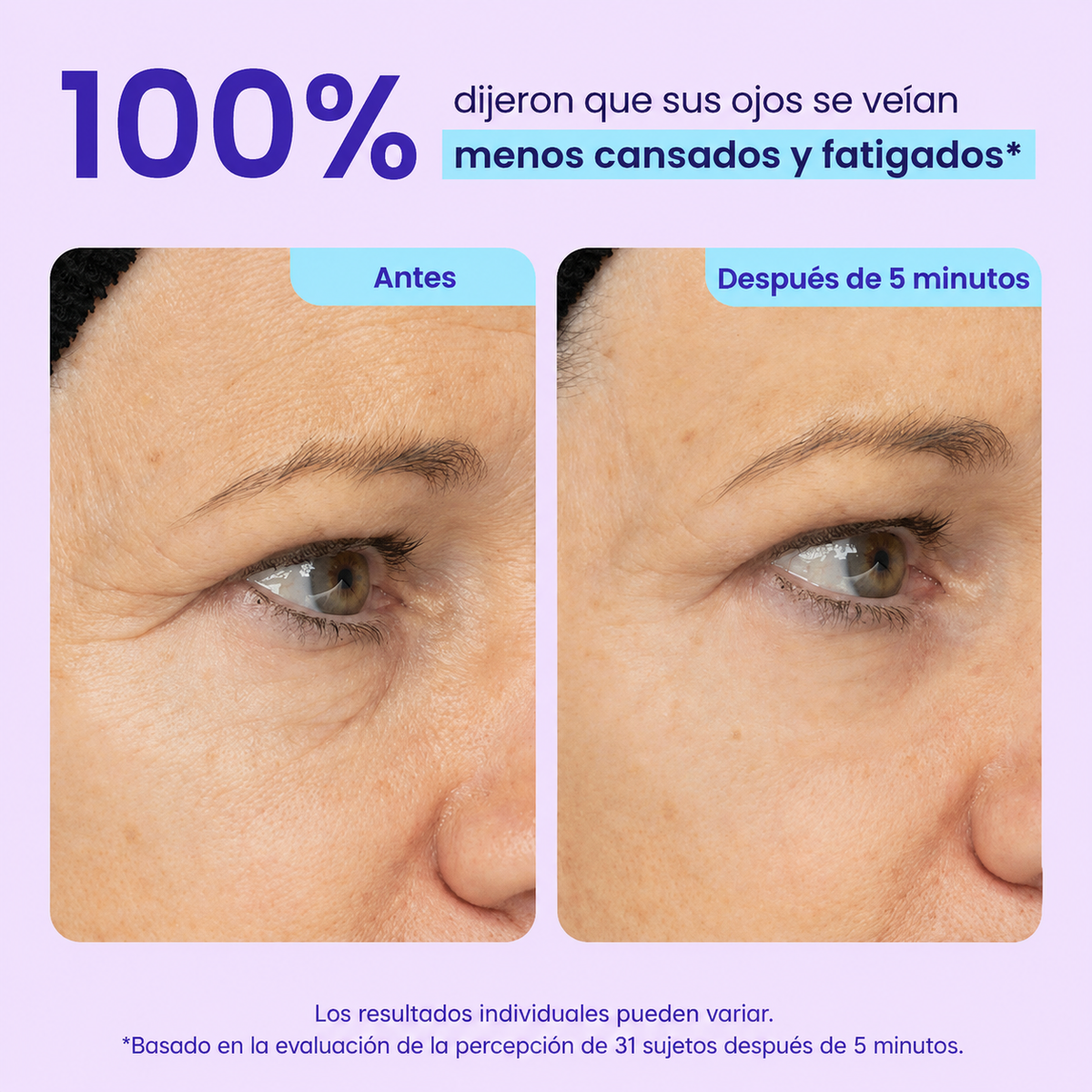 Gel de Ojos con Efecto Rejuvenecedor Instantáneo - #1 más viral en TikTok