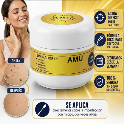 Crema Amu eliminador de verrugas, lunares, mexquinos, piojos y acrocordones